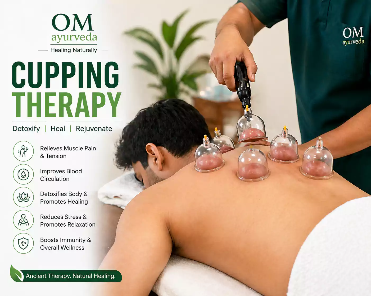 Cupping Therapy